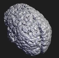BRAIN CT SCAN
