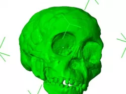 RadioLab Taung Child Skull (repaired, converted to mm)