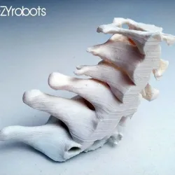 3D printed Cervical Spine