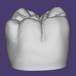 MACROMODEL LOWER MOLAR 46, LOWER MOLAR 46 MACROMODEL