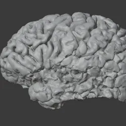 STROKE BRAIN MODEL