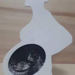 Ultrasound frame (eco frame)