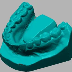 DENURE ROUGH FOR 3D PINTING