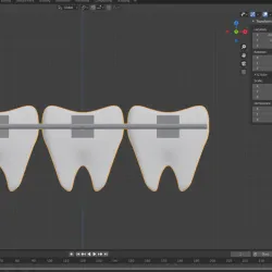 Molars with brackets. STL and Blender