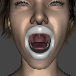 Clip-on mouth opener