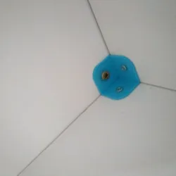 angle/corner fixation