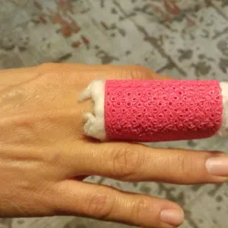 finger splints