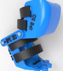 Prosthesis