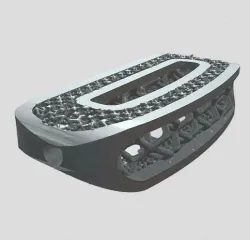Cage XLIF (Extreme Lateral Interbody Fusion )