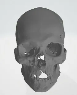 cranium