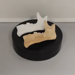 Human jaw with teeth (Scale 1:1)
