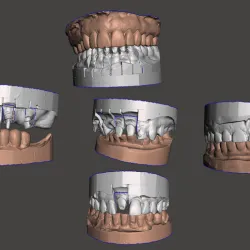 SAMPLE DATA FOR DENTAL DESIGN PRACTICE Pack B - Anteriors
