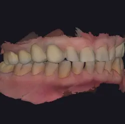Set of dental models for study