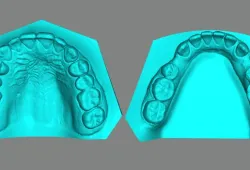 Dental Model/ Dental Model