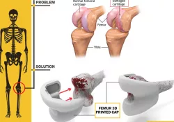 Femur 3D_Printed