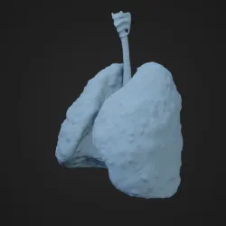 Human Lung Cancer