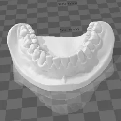 dental impression