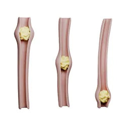 Peristalsis Function