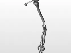 Left arm
