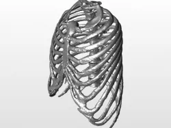 Ribcage
