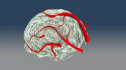 Tumor_Small w Blood Vessels.ics