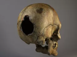 Man Skull Cracked 3D model