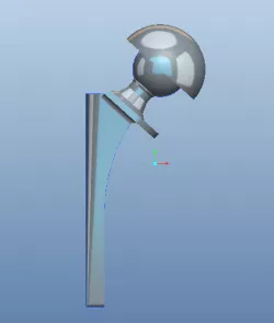 Hip Replacement