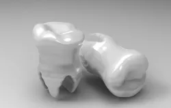 Molar Teeth