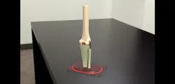 knee joint