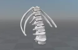 Lumbar rib - 13th extra rib 3D model