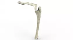 Left leg