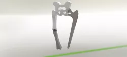 Hip and knee prosthesis Prototype (Protesis de cadera y rodilla)