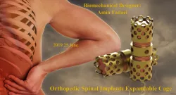 Orthopedic Spinal Implants Expandable Cage