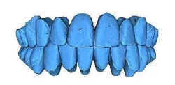 Human Teeth  3D print model