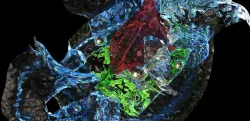 Abstract surfaces