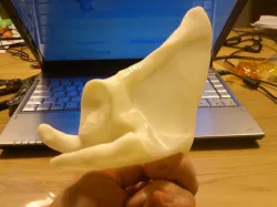 Scapula (Anatomical bone)