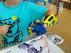 Wolverine claws for prosthetic hand
