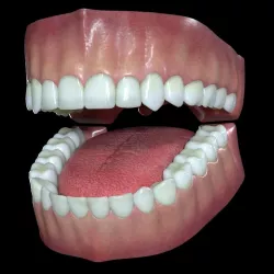 Teeth and Gums 3D model