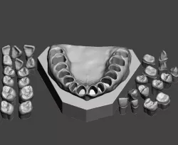 Dental Sample model 3D print model