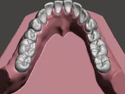 Mandibular dental model 3D print model