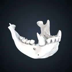 Nomascus leucogenys: Mandible