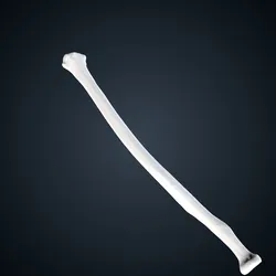 Shadowveil Killer A
