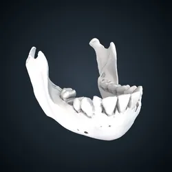 Pongo pygmaeus: mandible