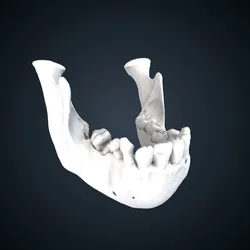 Pongo pygmaeus: mandible