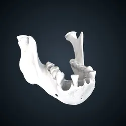 Pongo pygmaeus: mandible