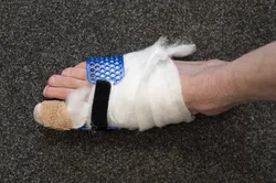 Big toe brace (splint)
