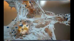 Cancer Cells 3D model Low-poly 3D model