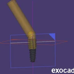 Implant Angle & GH Verifier