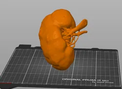 Human Kidney from CT Scan