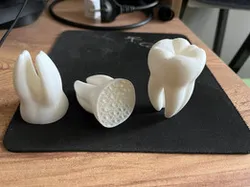 Dental / Tooth (3D Printing Model)